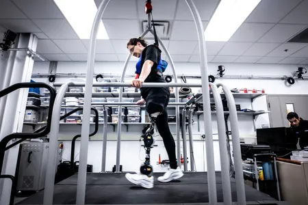 A patient tests an open-source robotic leg on a treadmill.