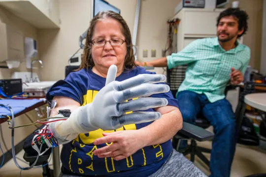 Karen Sussex, an upper-limb amputee from Jackson, Mich., operates a Touch Bionics I-LIMB prosthetic hand as Alex Vaskov, robotics Ph.D. candidate, looks on during a testing session at a lab in the University of Michigan Hospital in Ann Arbor, MI on June 13, 2019, for an advanced prosthetics study at U-M.