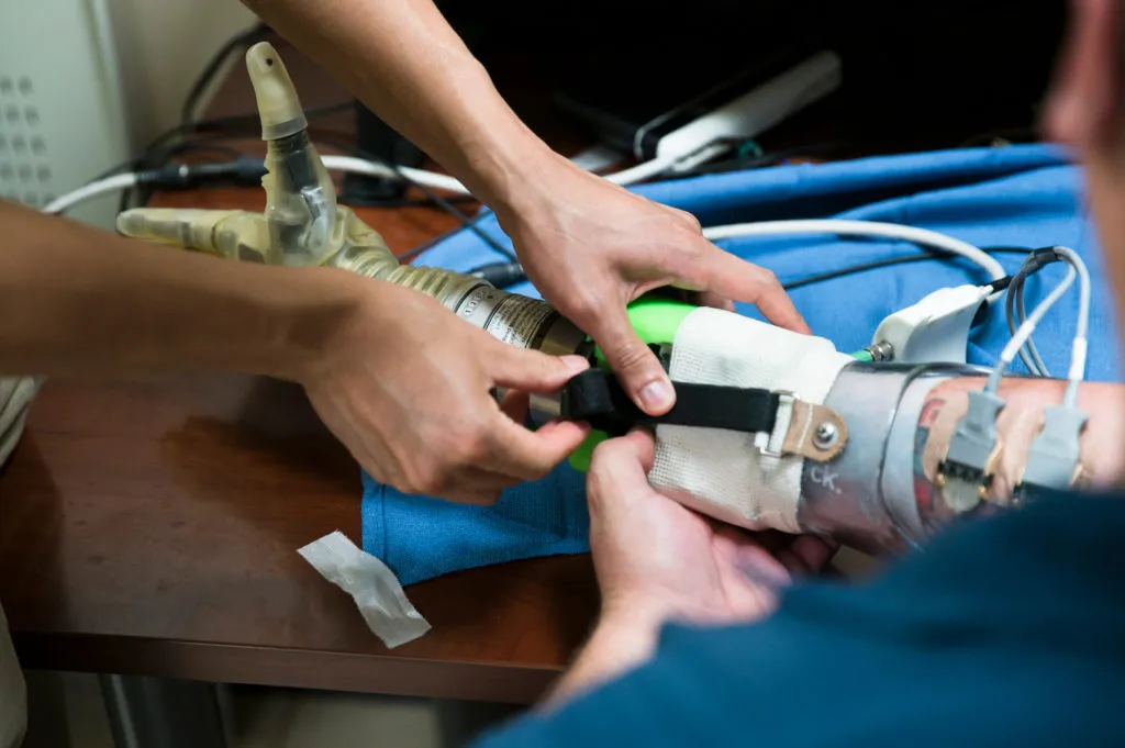 A prosthetic arm is adjusted on a study participant