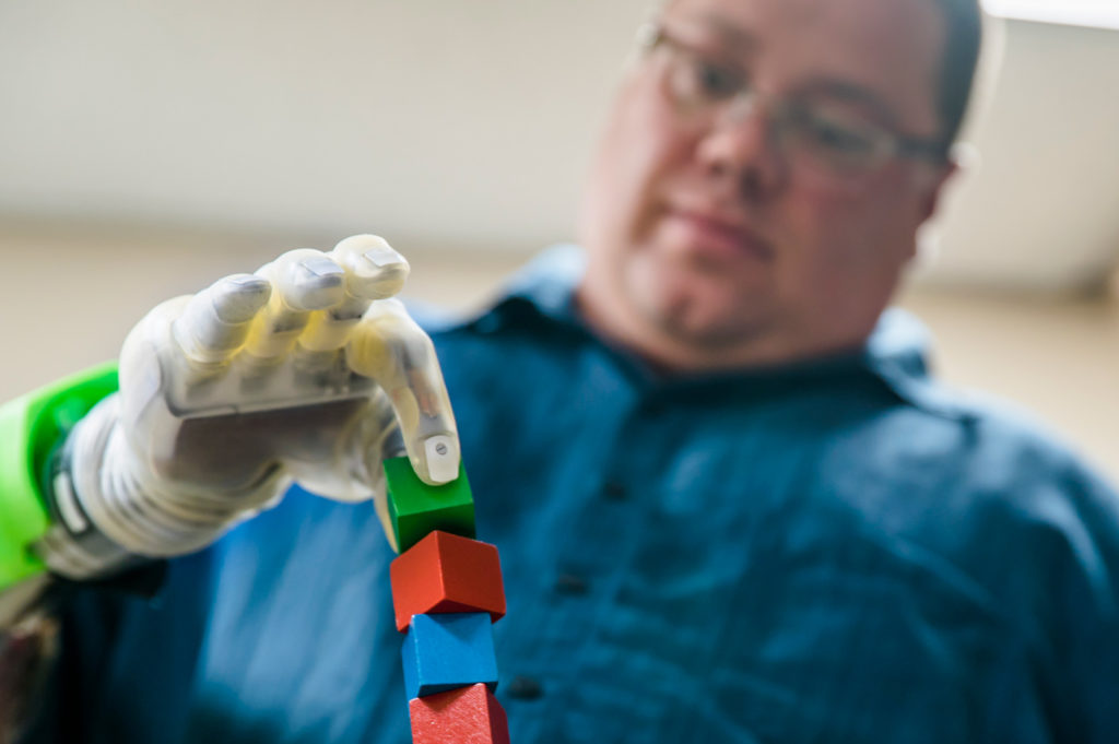 A man stacks cubes using a prosthetic arm