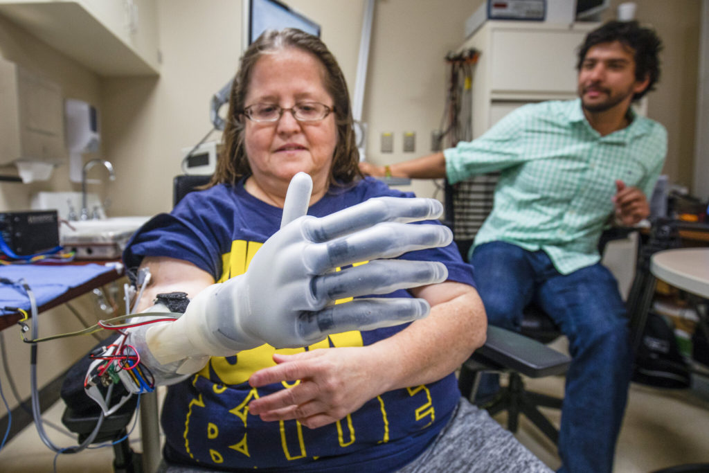 Karen Sussex, an upper-limb amputee from Jackson, Mich., operates a Touch Bionics I-LIMB prosthetic hand as Alex Vaskov, robotics Ph.D. candidate, looks on during a testing session at a lab in the University of Michigan Hospital in Ann Arbor, MI on June 13, 2019, for an advanced prosthetics study at U-M.